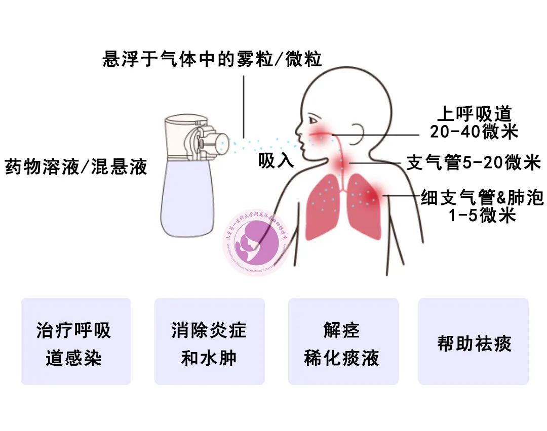 雾化图片.jpg